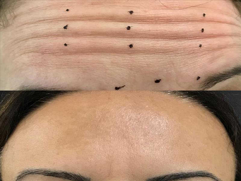 Casos Antes e Depois: Harmonização Facial - Skin Boutique